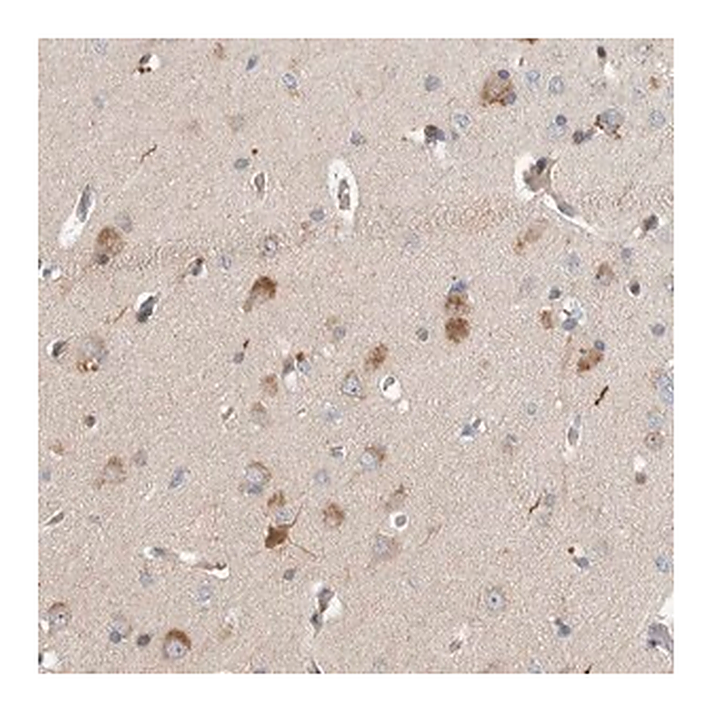 Merck Anti-LZTS1 antibody produced in rabbit