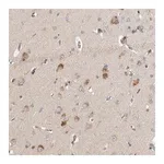 Merck Anti-LZTS1 antibody produced in rabbit