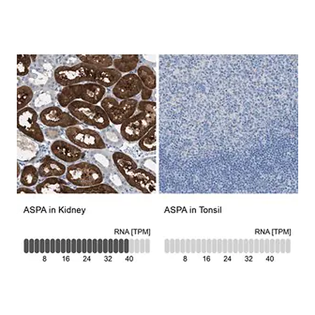 Merck Anti-ASPA antibody produced in rabbit