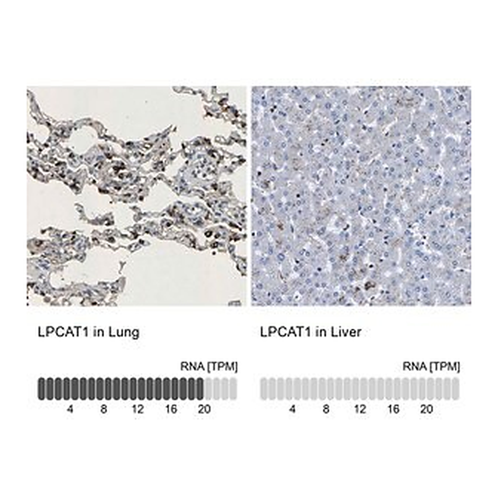 Merck Anti-LPCAT1 antibody produced in rabbit