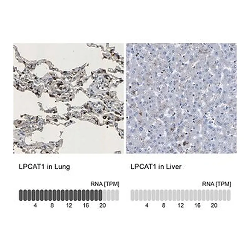 Merck Anti-LPCAT1 antibody produced in rabbit