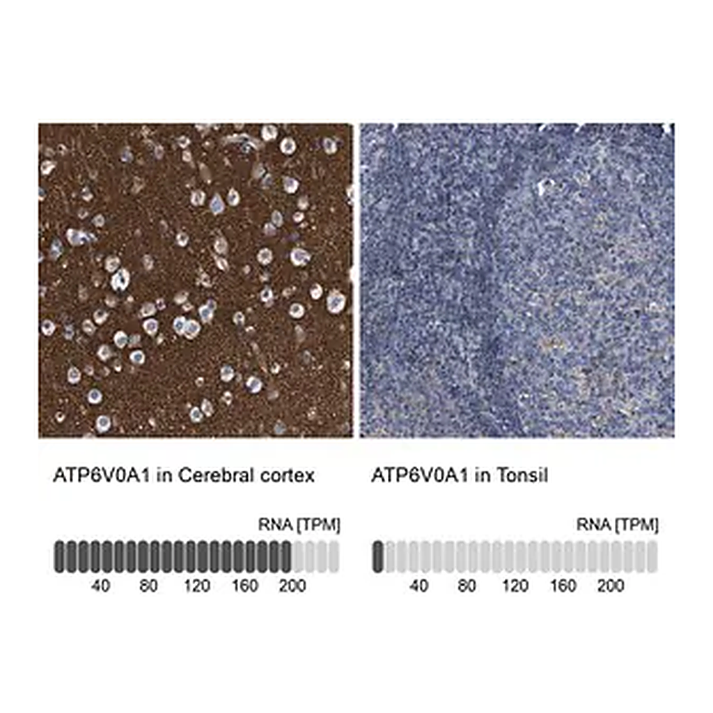 Merck Anti-ATP6V0A1 antibody produced in rabbit