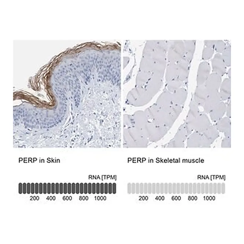 Merck Anti-PERP antibody produced in rabbit