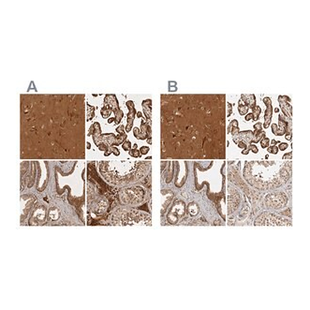 Merck Anti-CAMSAP2 antibody produced in rabbit