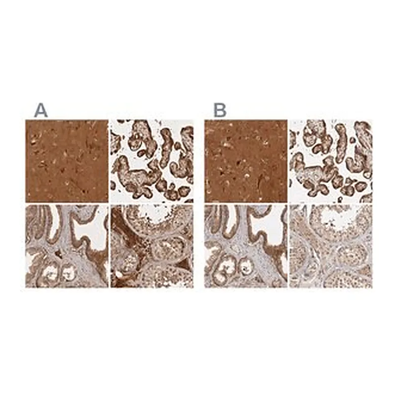 Merck Anti-CAMSAP2 antibody produced in rabbit