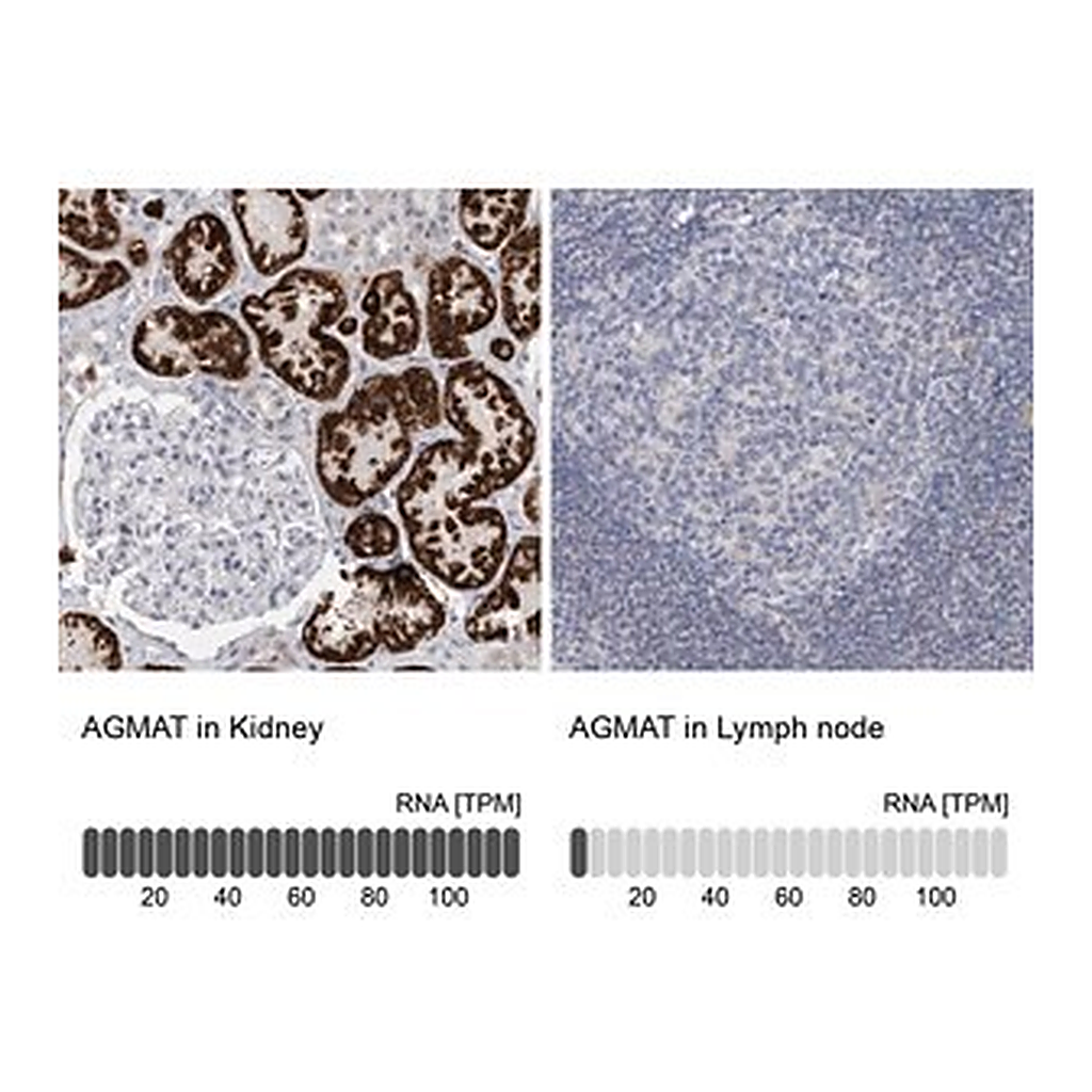 Merck Anti-AGMAT antibody produced in rabbit