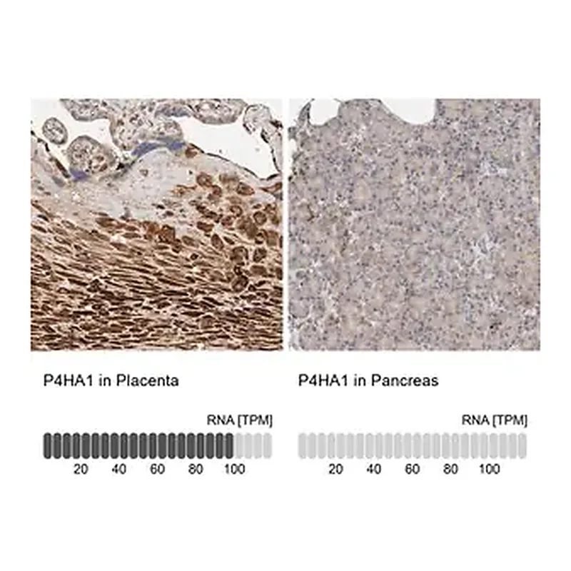 Merck Anti-P4HA1 antibody produced in rabbit