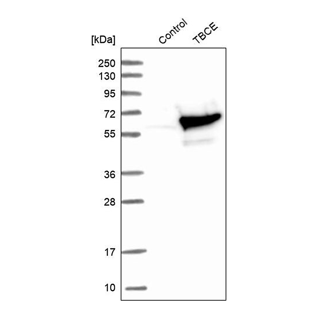 Merck Anti-TBCE antibody produced in rabbit