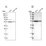 Merck Anti-DDX6 antibody produced in rabbit