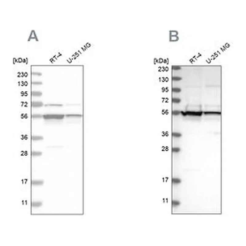 Merck Anti-DDX6 antibody produced in rabbit