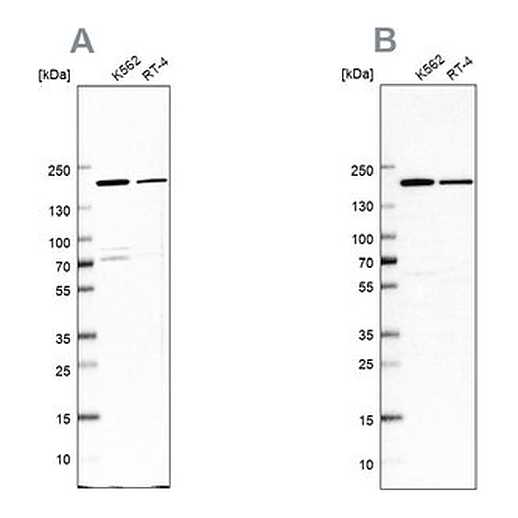 Merck Anti-EPRS antibody produced in rabbit