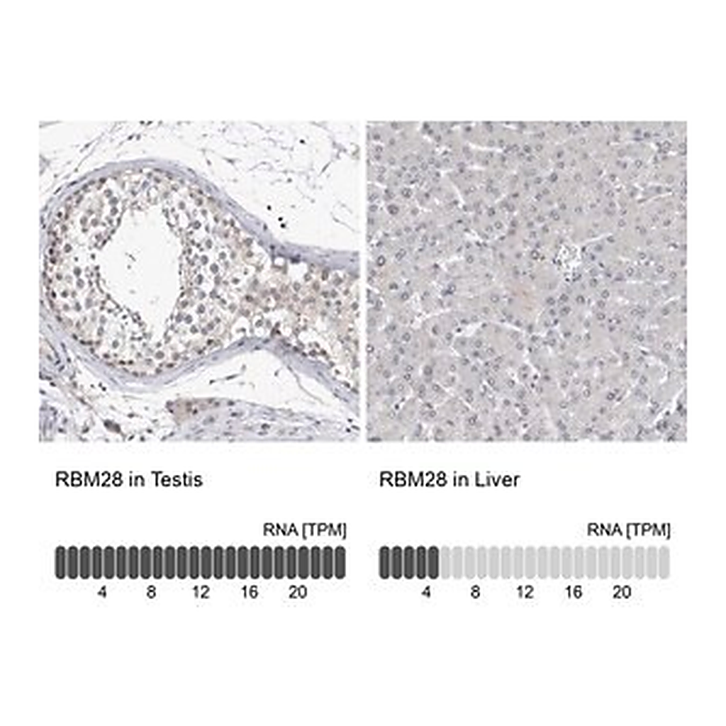 Merck Anti-RBM28 antibody produced in rabbit