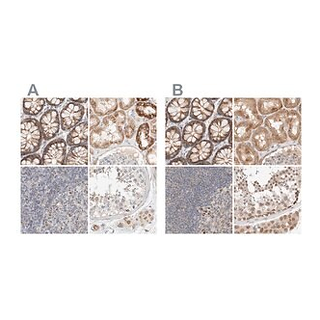 Merck Anti-MRM3 antibody produced in rabbit