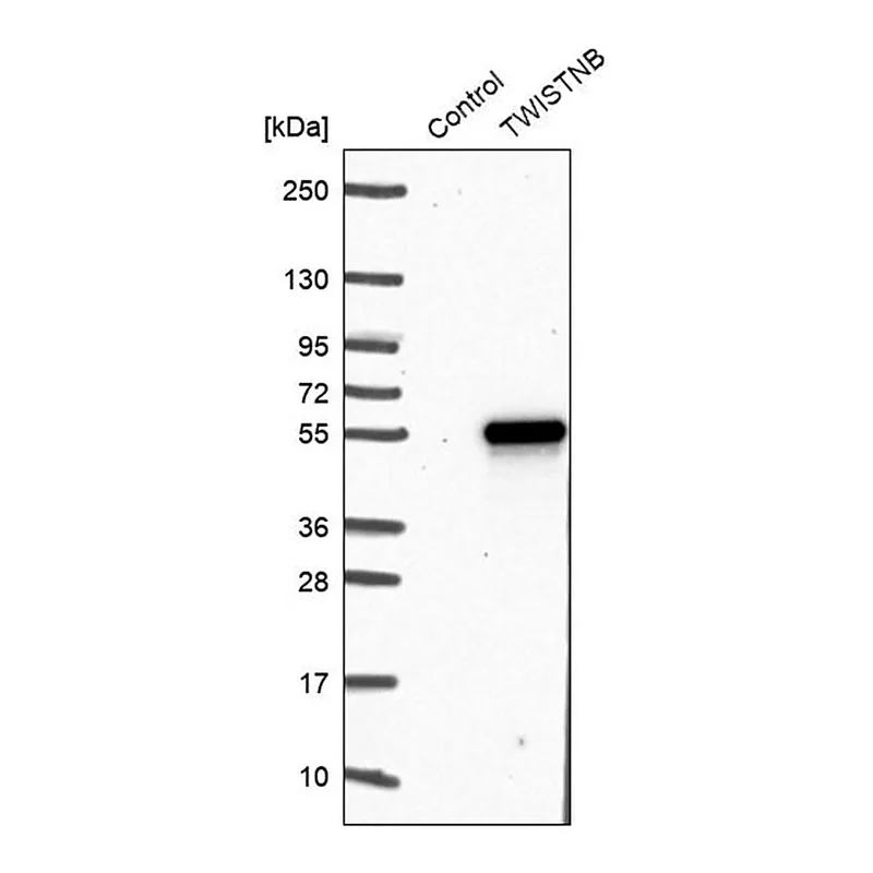 Merck Anti-TWISTNB antibody produced in rabbit