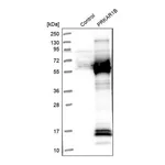 Merck Anti-PRKAR1B antibody produced in rabbit