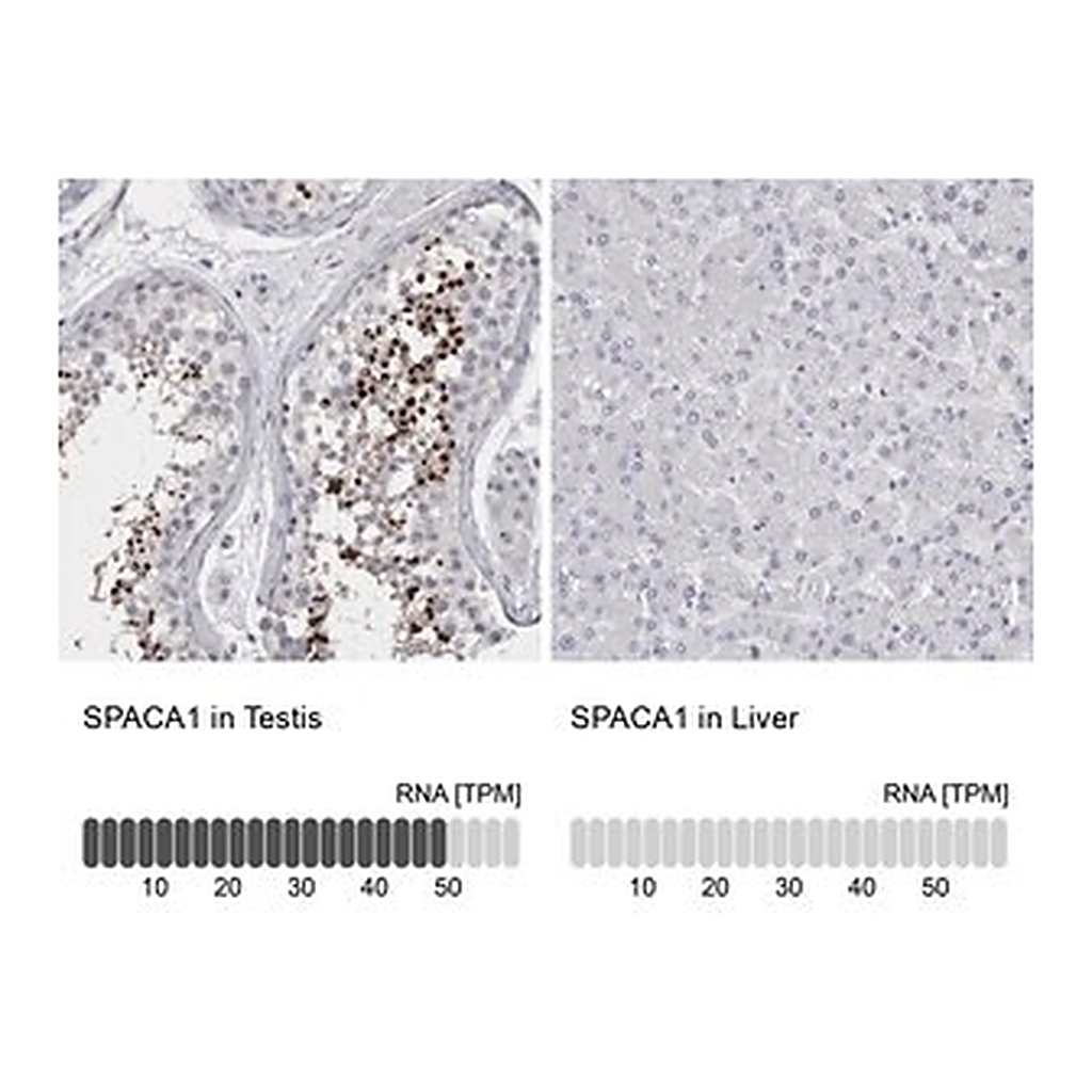Merck Anti-SPACA1 antibody produced in rabbit