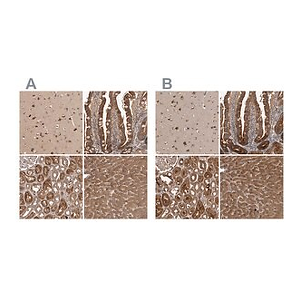 Merck Anti-TRMT61B antibody produced in rabbit