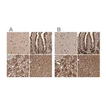 Merck Anti-TRMT61B antibody produced in rabbit