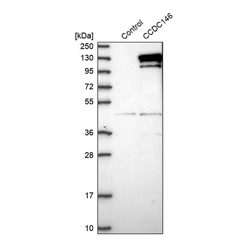Merck Anti-CCDC146 antibody produced in rabbit
