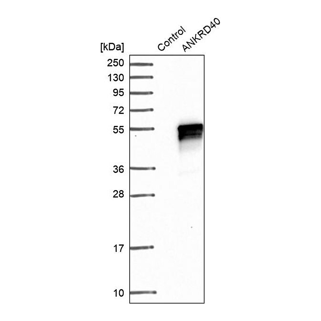 Merck Anti-ANKRD40 antibody produced in rabbit