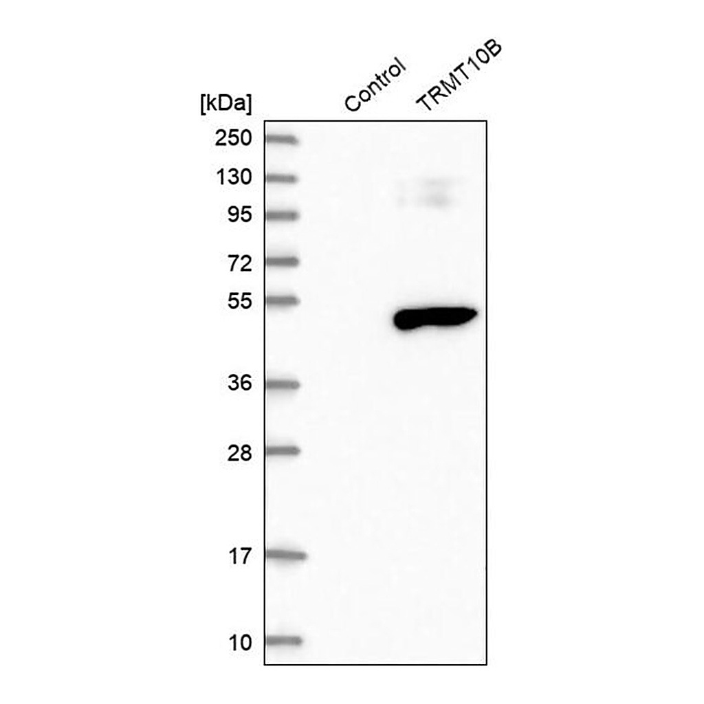 Merck Anti-TRMT10B antibody produced in rabbit
