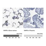 Merck Anti-MMP8 antibody produced in rabbit