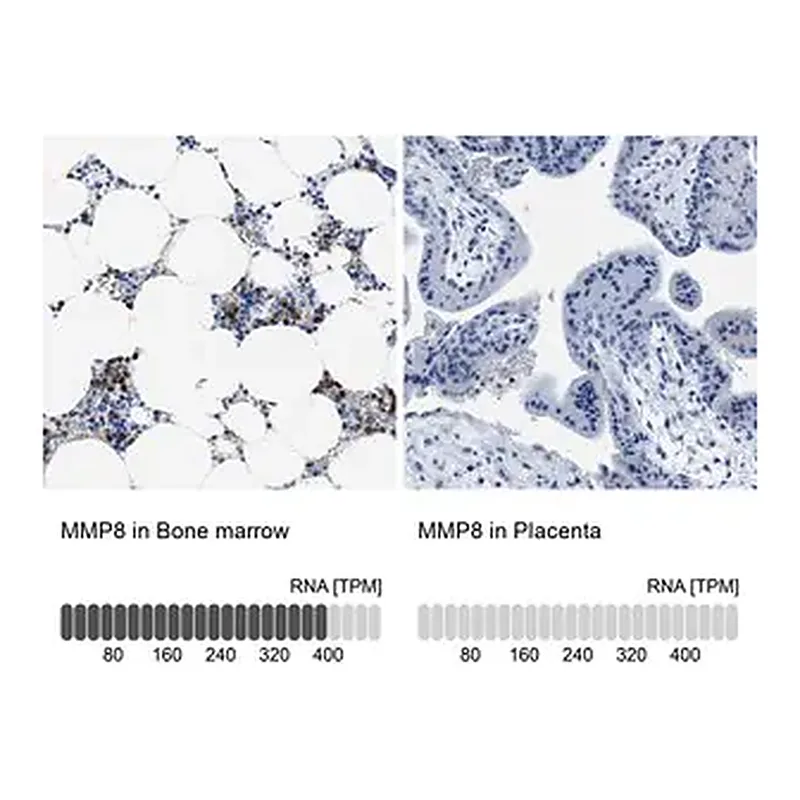 Merck Anti-MMP8 antibody produced in rabbit