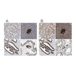 Merck Anti-ACLY antibody produced in rabbit