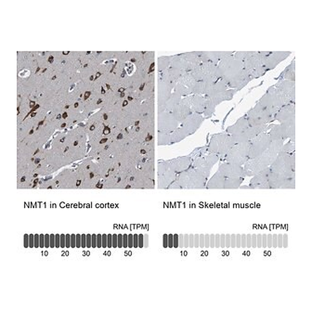Merck Anti-NMT1 antibody produced in rabbit