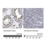Merck Anti-CALCOCO2 antibody produced in rabbit