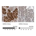 Merck Anti-SCRN2 antibody produced in rabbit