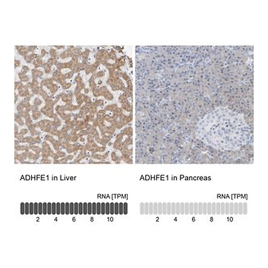Merck Anti-ADHFE1 antibody produced in rabbit