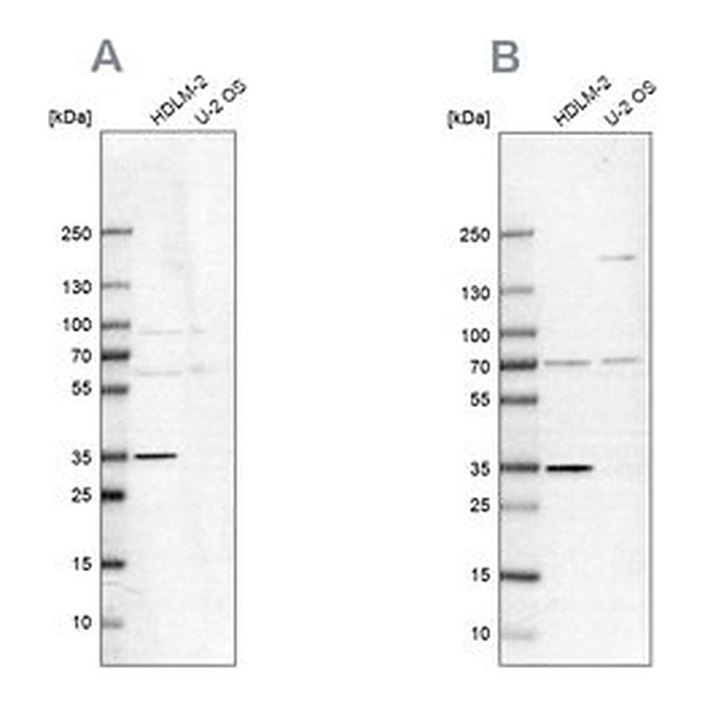 Merck Anti-TTC19 antibody produced in rabbit
