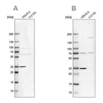 Merck Anti-TTC19 antibody produced in rabbit