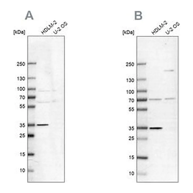 Merck Anti-TTC19 antibody produced in rabbit