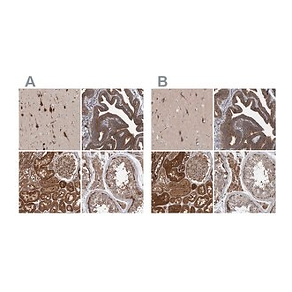 Merck Anti-KIAA0753 antibody produced in rabbit