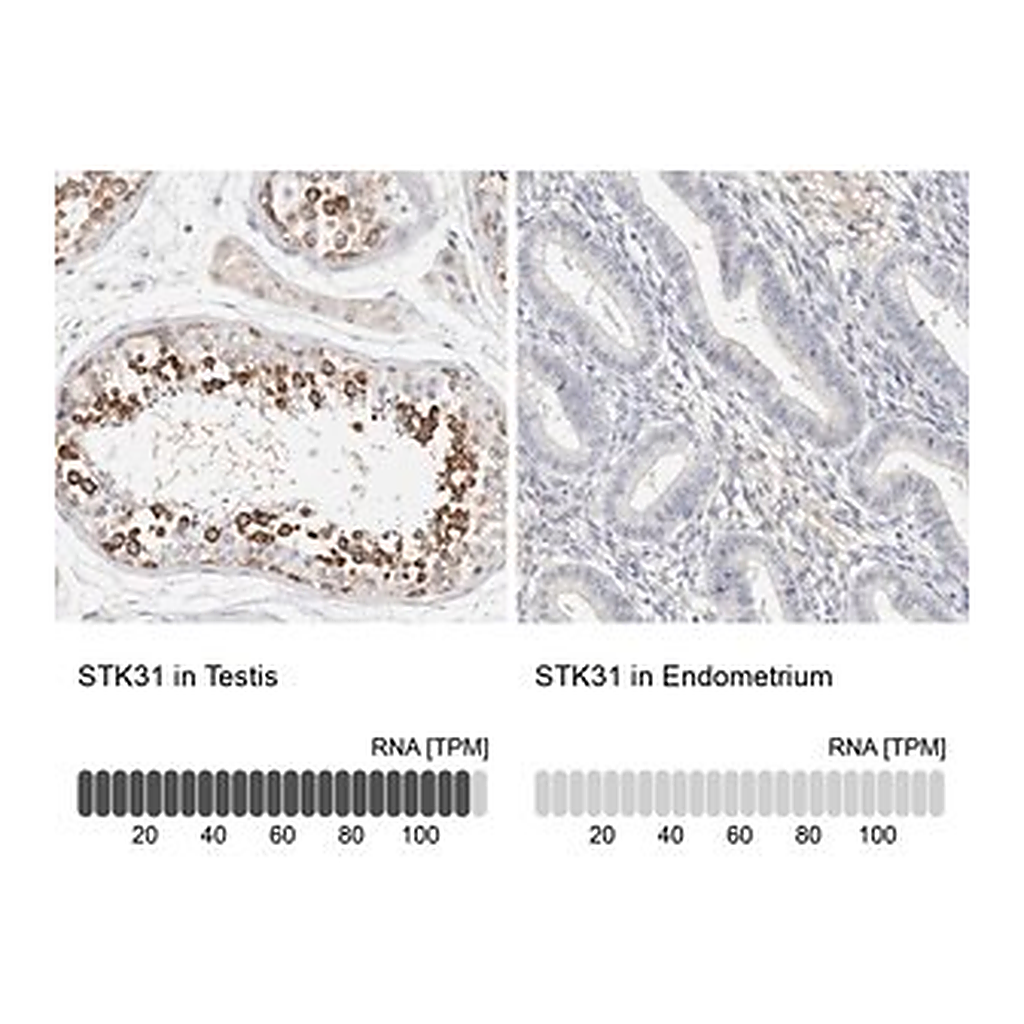 Merck Anti-STK31 antibody produced in rabbit