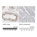 Merck Anti-STK31 antibody produced in rabbit