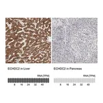 Merck Anti-ECHDC2 antibody produced in rabbit