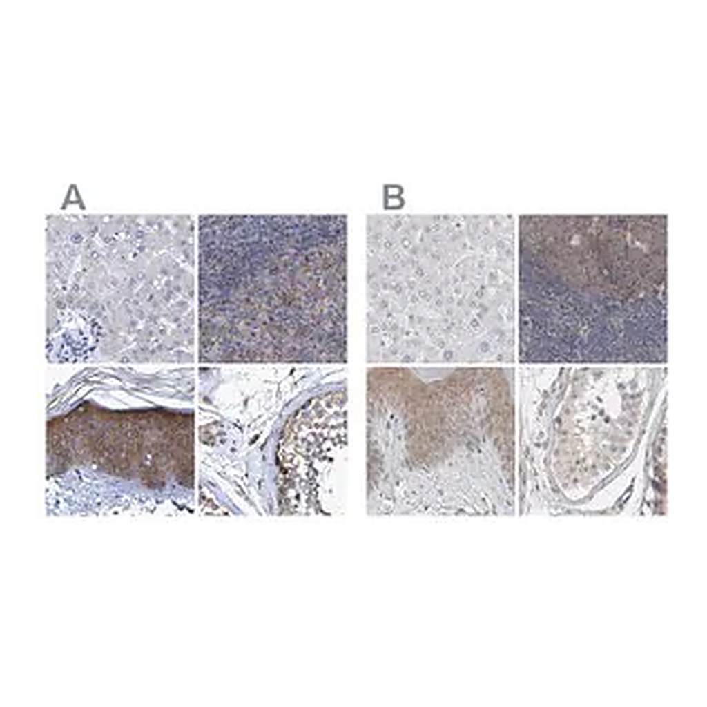 Merck Anti-BICD2 antibody produced in rabbit