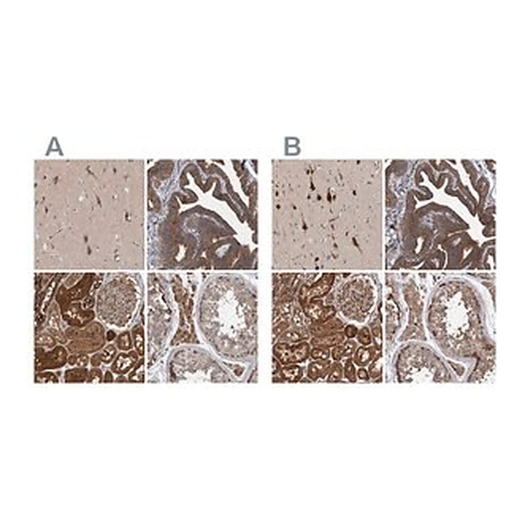 Merck Anti-KIAA0753 antibody produced in rabbit
