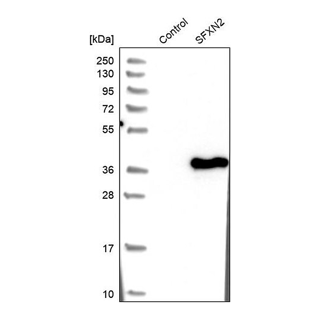 Merck Anti-SFXN2 antibody produced in rabbit