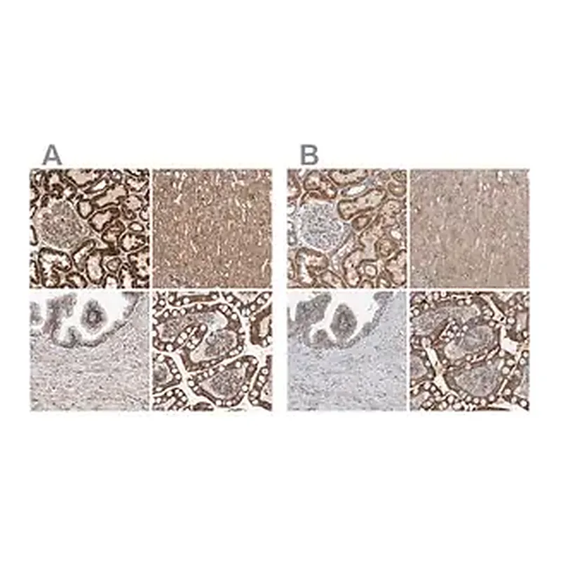 Merck Anti-MRPL45 antibody produced in rabbit