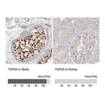 Merck Anti-TOP2A antibody produced in rabbit