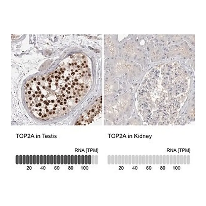 Merck Anti-TOP2A antibody produced in rabbit