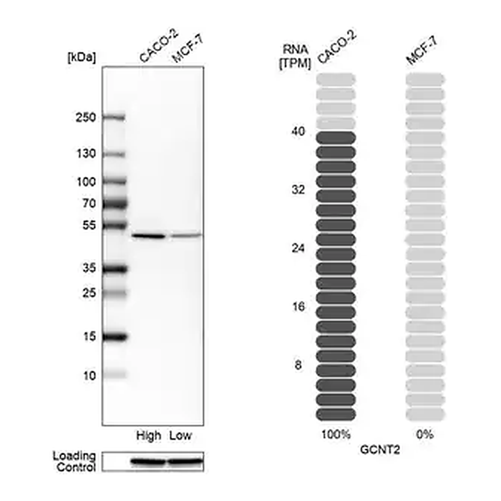 Merck Anti-GCNT2 antibody produced in rabbit
