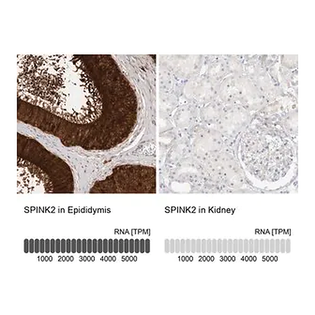 Merck Anti-SPINK2 antibody produced in rabbit