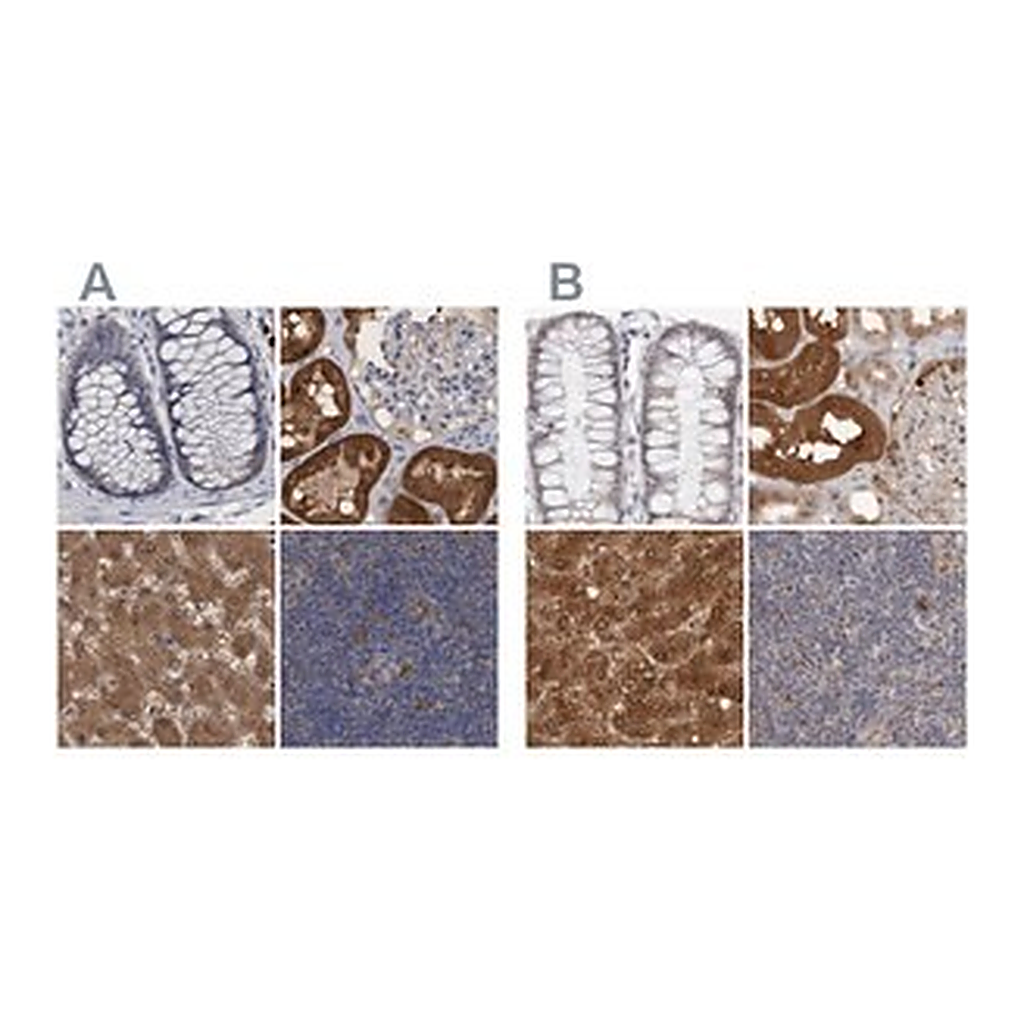 Merck Anti-PNPO antibody produced in rabbit