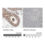 Merck Anti-NPLOC4 antibody produced in rabbit