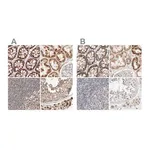Merck Anti-MRM3 antibody produced in rabbit